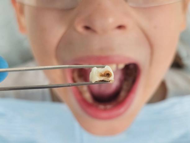 Best Pediatric Emergency Dentist in Union, KY